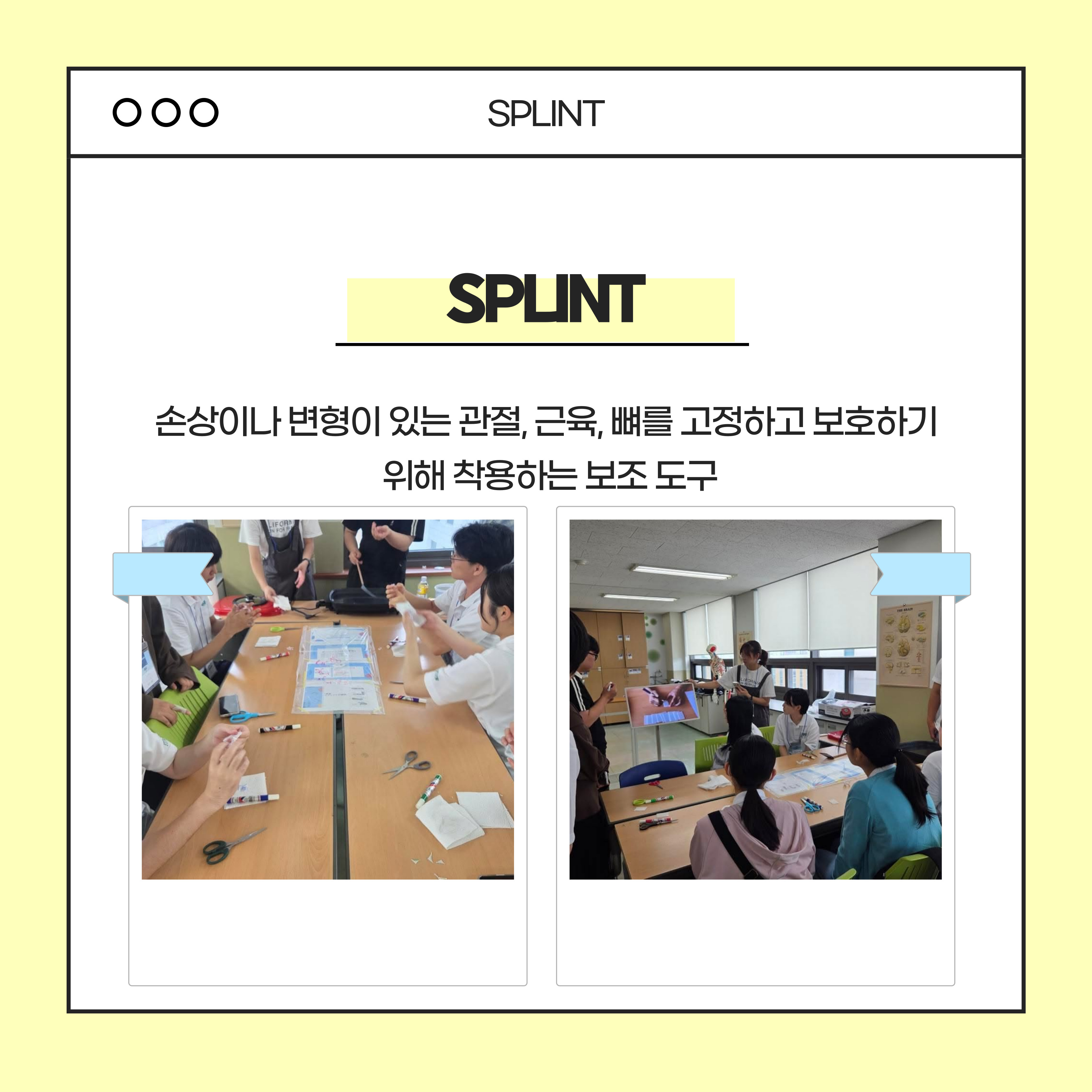 썸네일 사진